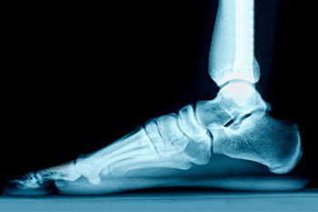 digital x-rays