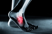 Relief From Foot Stress Fractures